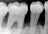 A Dental Radiograph